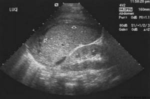 ultrasound of the stomach, abdominal cavity