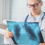 What are the differences between MRI and CT of the lungs?