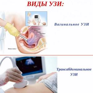 types of ultrasound for women