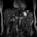 Visualization of biliary tract organs on an MR scan