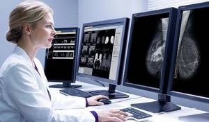 Doctor looking at mammography result