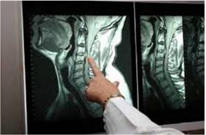 doctor looking at an MRI scan