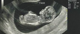 Is ultrasound harmful to the fetus?