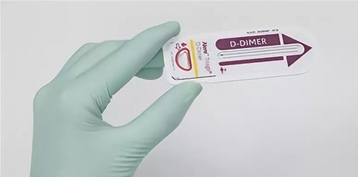 Is it always necessary to take D-dimer - Alkoklinik