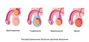 diseases of the scrotum