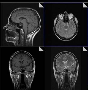 Recording MRI images onto film or CD
