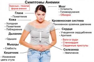Женщина держится за живот и приводится перечисление симптомов анемии