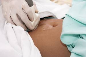A woman undergoes a transabdominal ultrasound